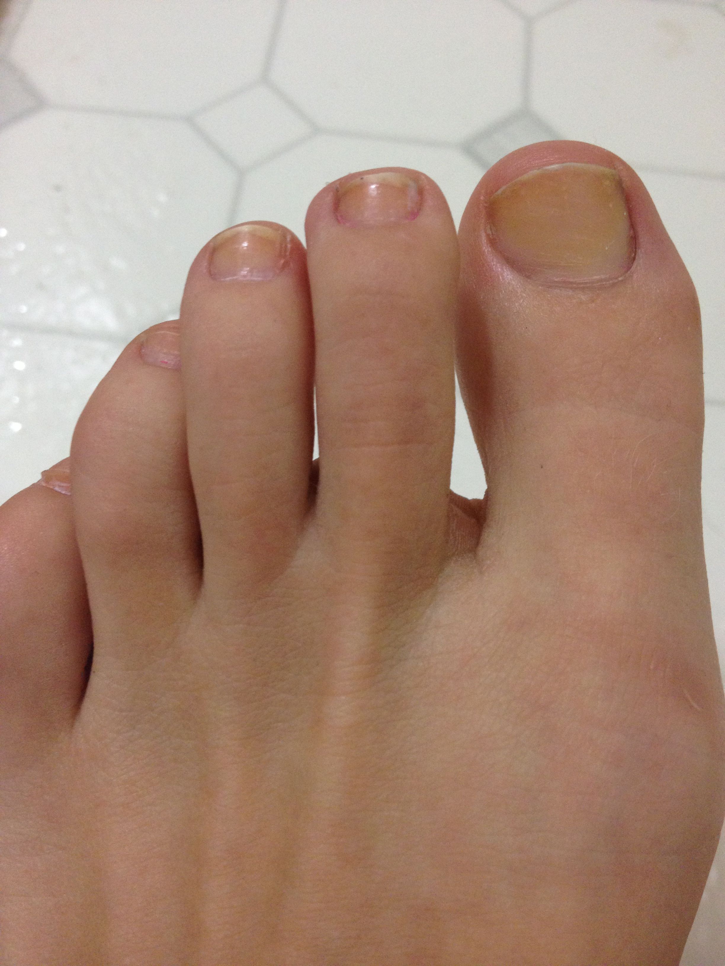 This Is Why Your Toenails Smell So Bad | livestrong